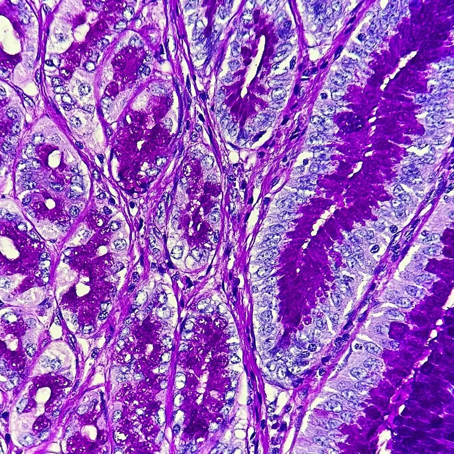 PAS stain of intestinal epithelium showing magenta-positive mucin