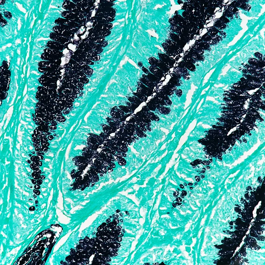 GMS silver stain of intestinal epithelium, close-up