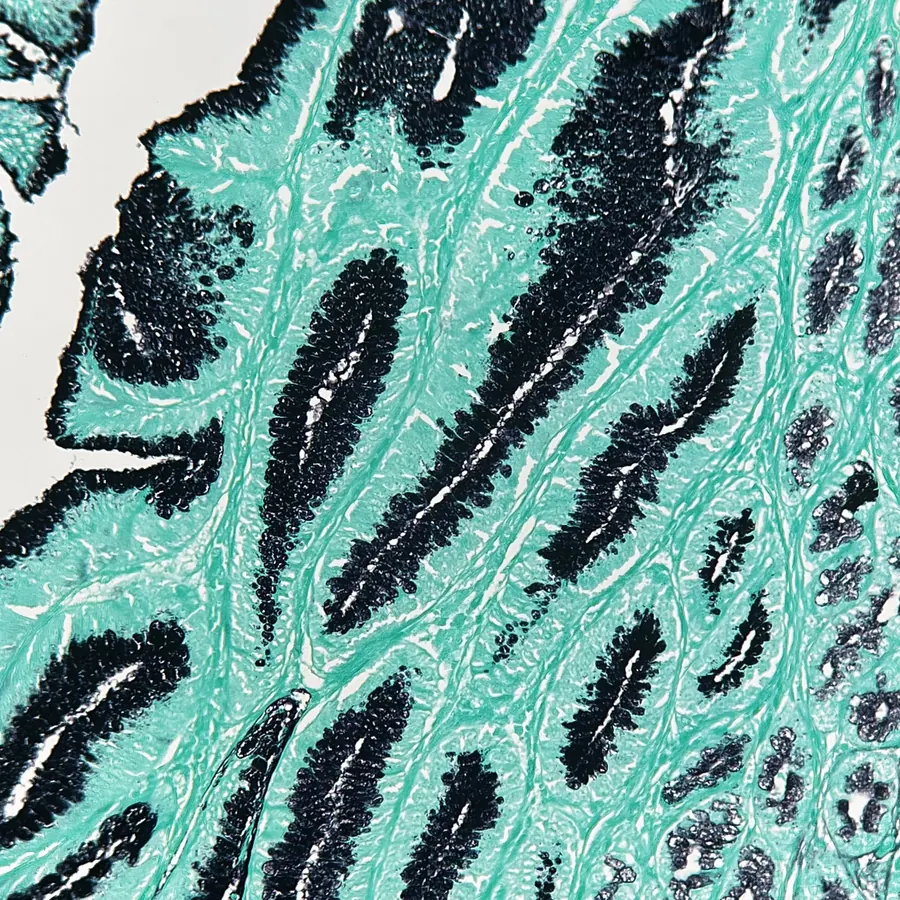 GMS silver stain of intestinal epithelium, wider field showing villous pattern